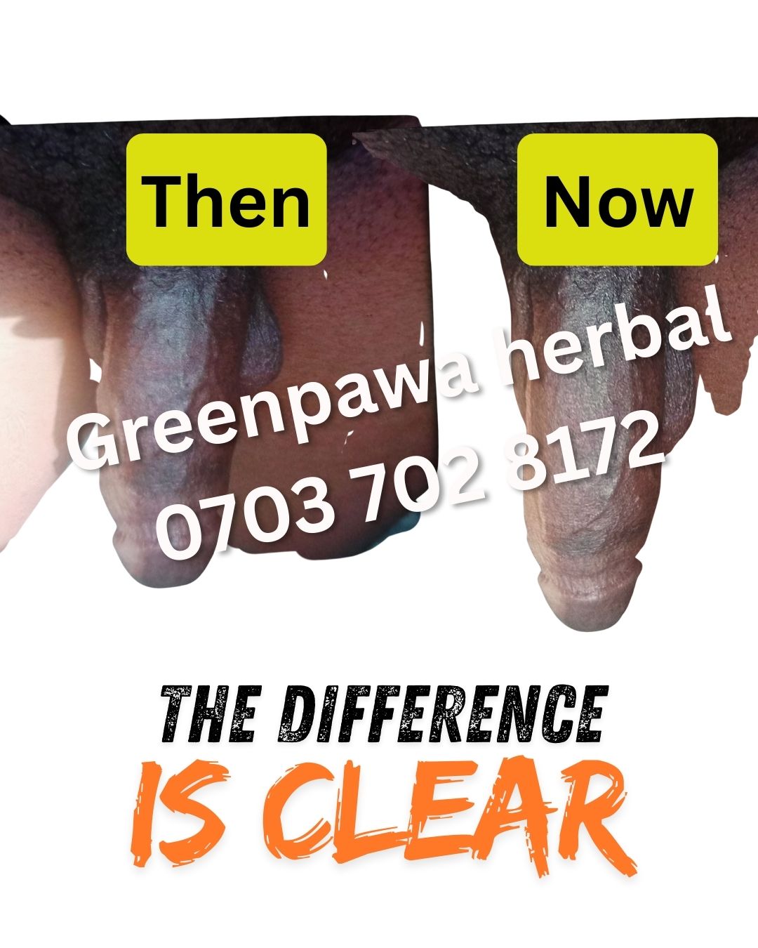 Greenpawa Gbola Enlargement oil dick enlargement oil testimony6