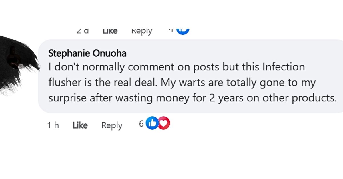 warts treatment testimony