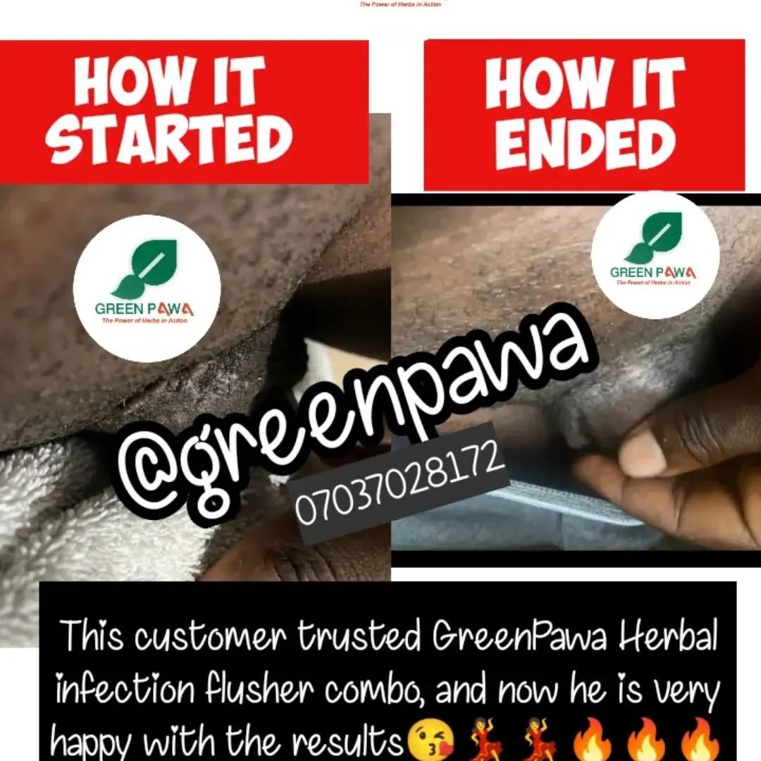 wart treatment testimony